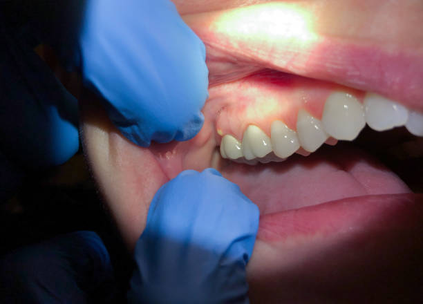 Best Emergency Orthodontic Repairs in St Henry, OH