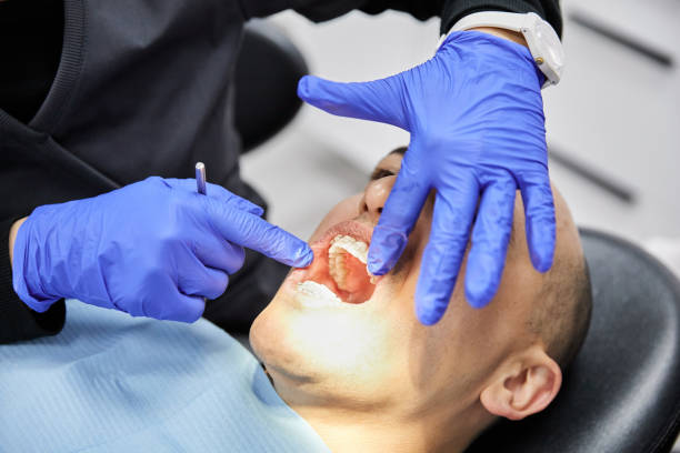 Best Dental Abscess Treatment in St Henry, OH