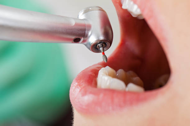 Best Emergency X-Rays and Diagnostics in St Henry, OH